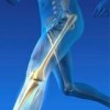 Premier Orthopedic Solutions Inc.